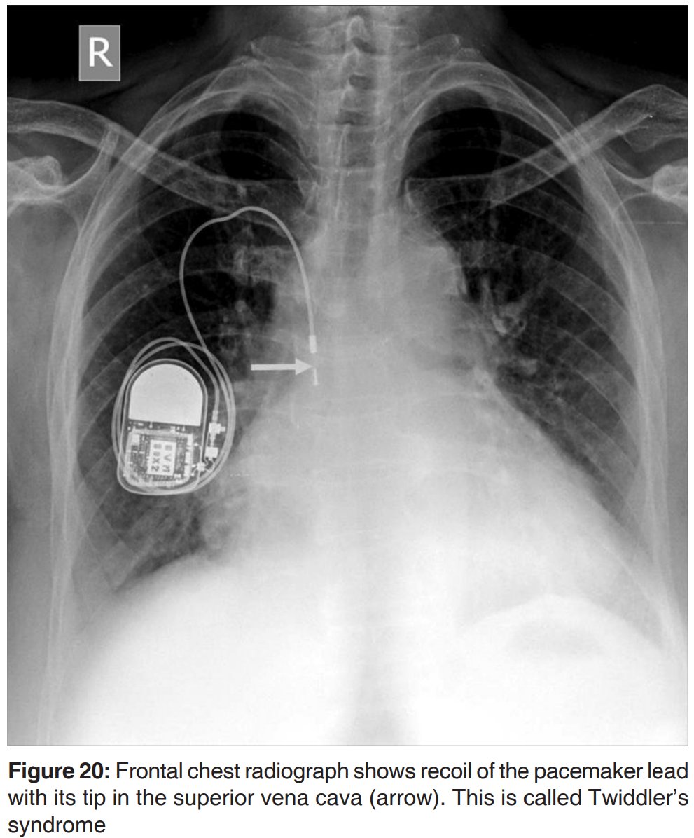 Hassler S. Macías-Sánchez tweet media