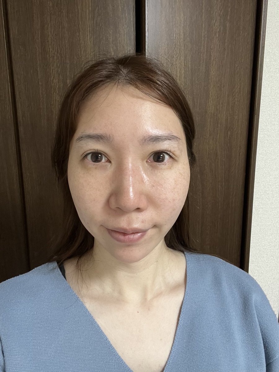 appp_____23's tweet image. ちょうど一年の変化です！
どう？ちょっとはマシになった？

#BeforeAndAfter  #韓国美容