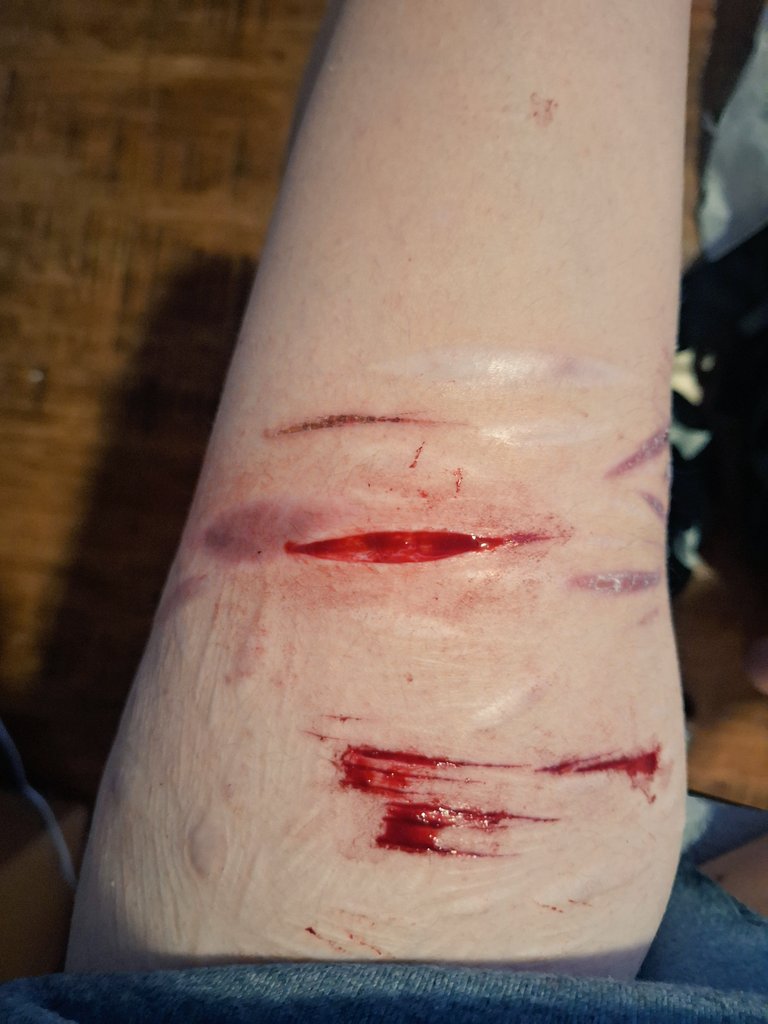 xxJe11o's tweet photo. I hit a nerve and my leg tweaked out so I quite early https://t.co/48zAQVYgJc