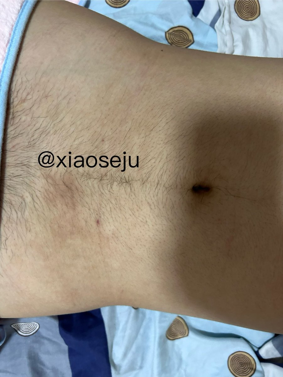 xiaoseju's tweet photo. 06的弟弟，害羞没让拍那里🤣#南昌脱毛 #男士脱毛 https://t.co/WjCaX70O3h