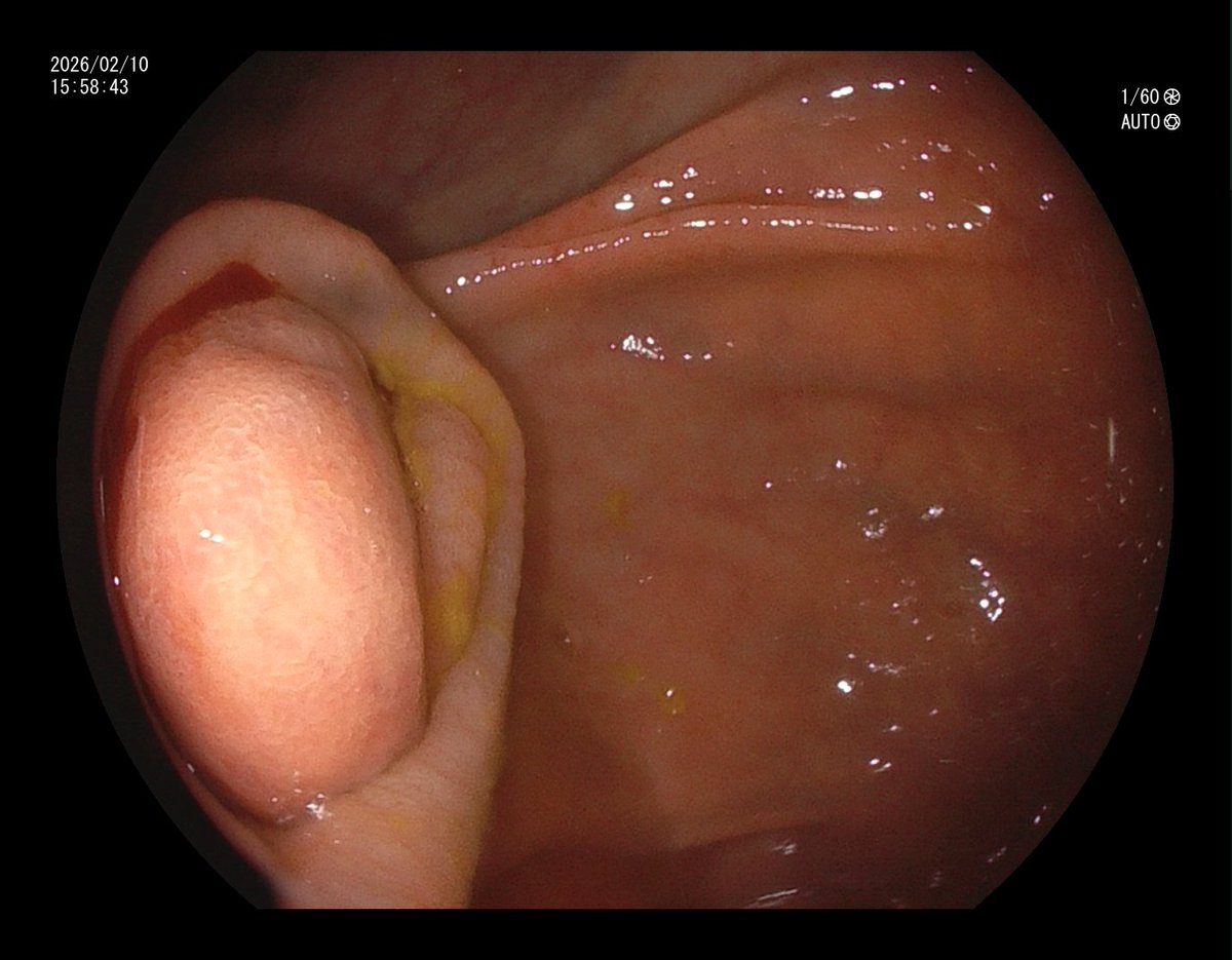 Aleksandar Gavric tweet media