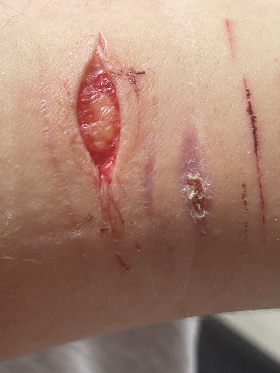 4gresiv0vrd0se's tweet photo. #haii new cvt, and a lil cig burn at the bottom right..Lmk if I hit beans or if It’s deep styro, I can’t tell- I hope it iss #shtwt #shedtwt https://t.co/TF1inffmlZ
