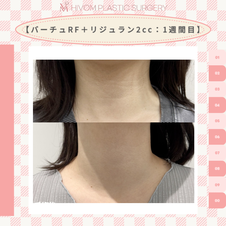 ハイボム美容外科🍑プチ整形🍑 tweet media