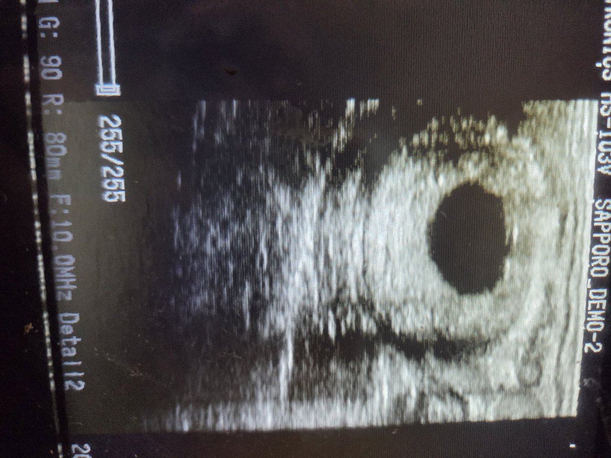 今日は妊婦鑑定 受胎していました✨ 幸先良いスタート☺️