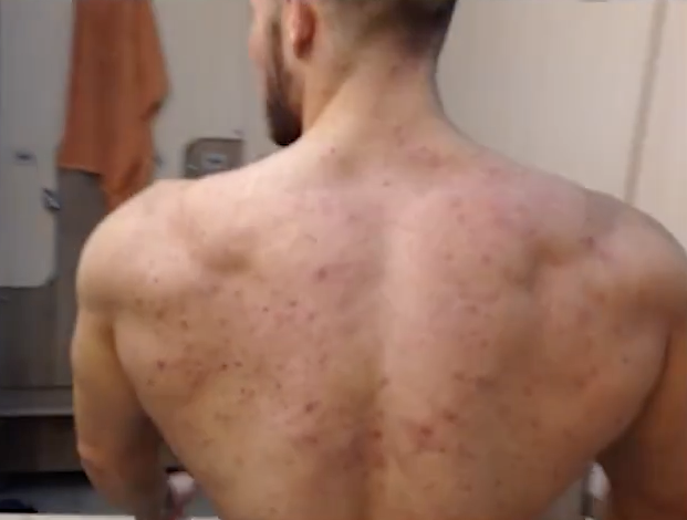Anabolic Alpha tweet media