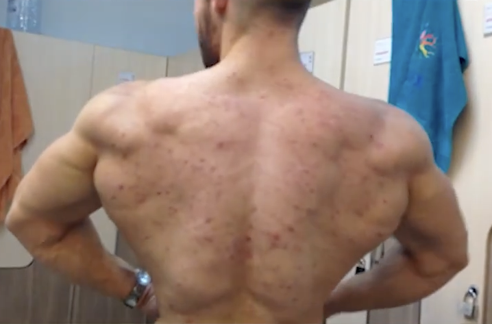 Anabolic Alpha tweet media