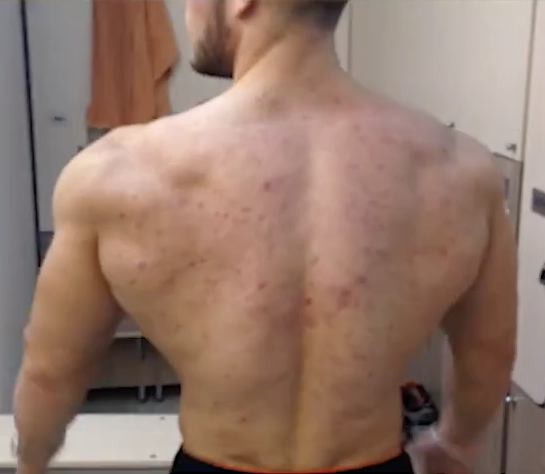 Anabolic Alpha tweet media
