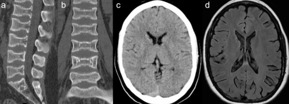 SPIN | Society of Pediatric Neuroimaging tweet media