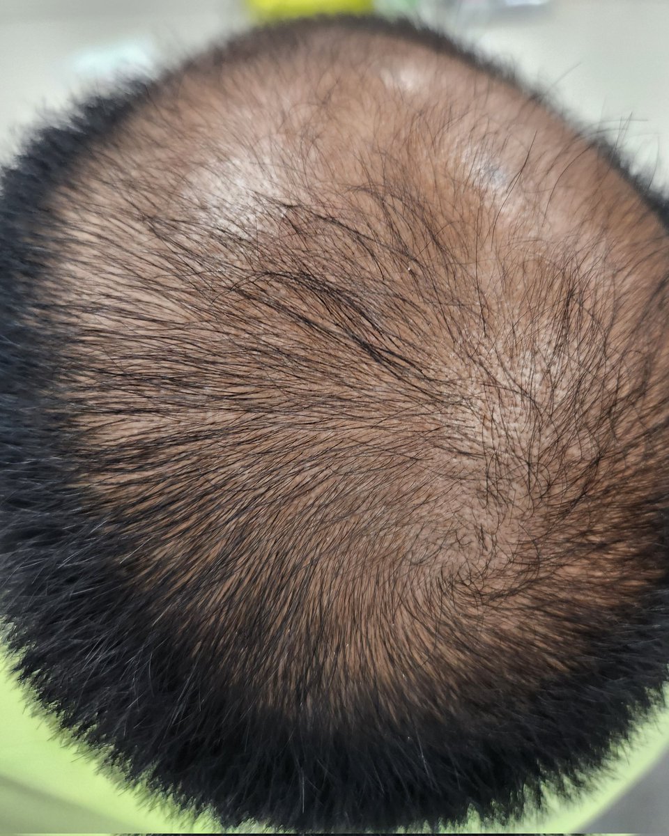 トム・ブラウンみちお🐸 tweet media