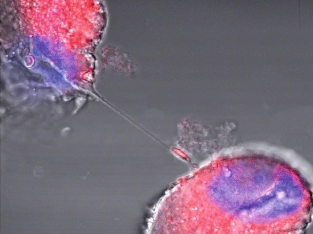 Biomedical Picture of the Day BPoD tweet media