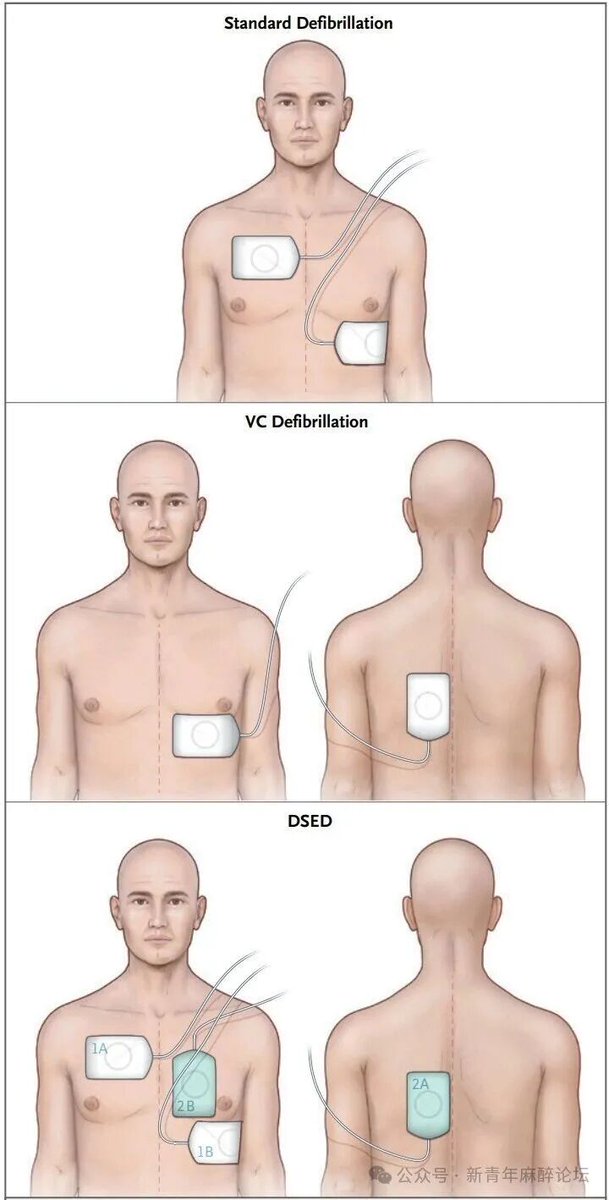 Anesthesiology and Perioperative Science tweet media