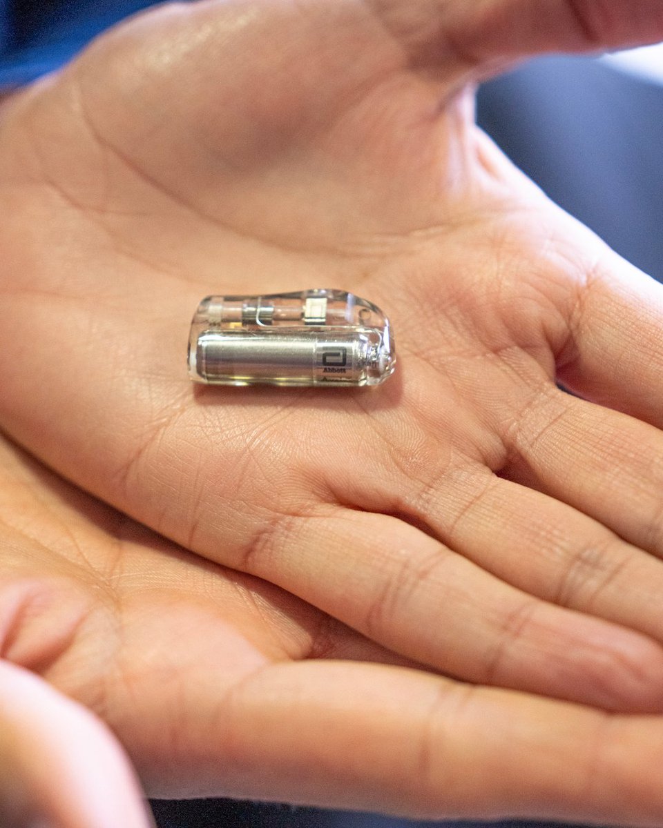 👶❤️ SJD implanta un marcapasos de 2 cm, el más pequeño del mundo, en un bebé de 2,1 kg.

Un sistema inalámbrico adaptado al corazón neonatal gracias al equipo de cardiología, cirugía cardíaca e ingenieros de Abbott.

La pequeña ya está en casa 🙌.

🔗 sjdhospitalbarcelona.org/es/noticias/sa…