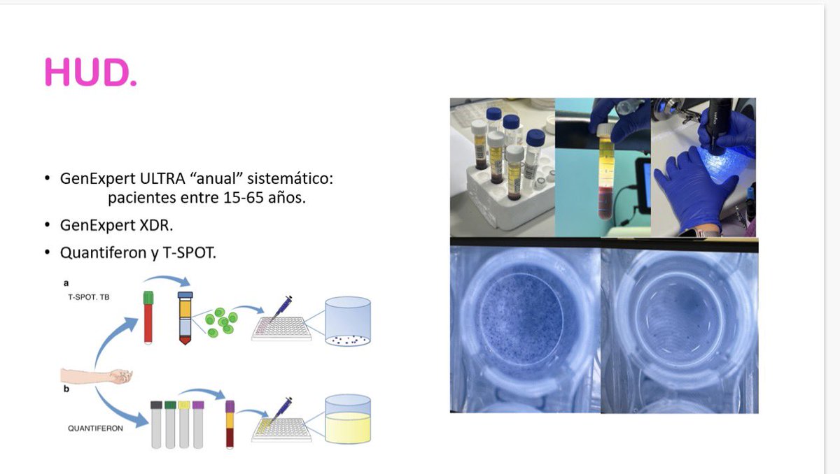 🖥️ #Sesión: Hoy nuestra residente María Amoroto👩🏻‍🔬 nos hace un repaso de las #MNT 🧫 con su papel en #clínica 😇➡️👿 y nos cuenta su #rotación por la Unidad de #micobacterias del <a href="/DonostiakoOsp/">OSI Donostialdea ESI</a> 📍¡Enhorabuena por la presentación! 😍🙌🏼