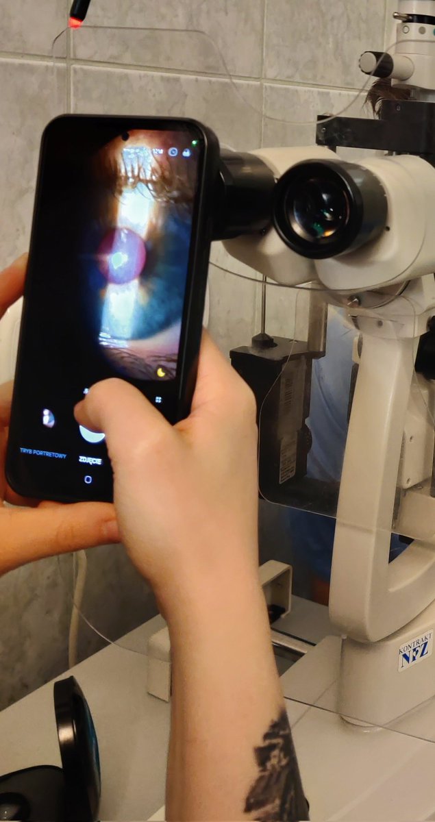 Diagnoza:
Spierdala mi oko na jej dupe