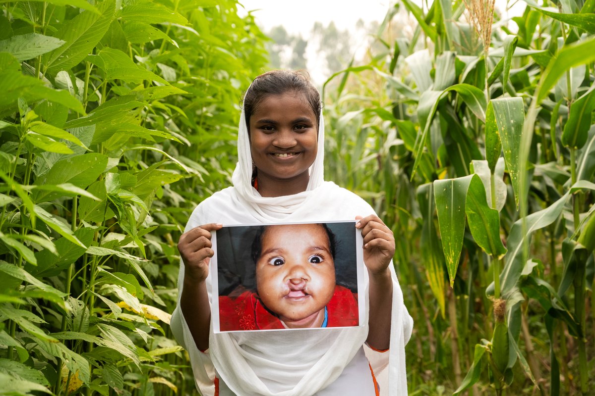 Smile Train tweet media