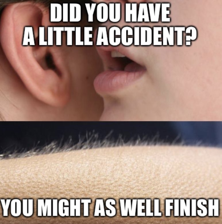 Did you have a little accident?