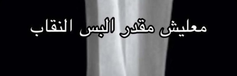 كبشتينه tweet media