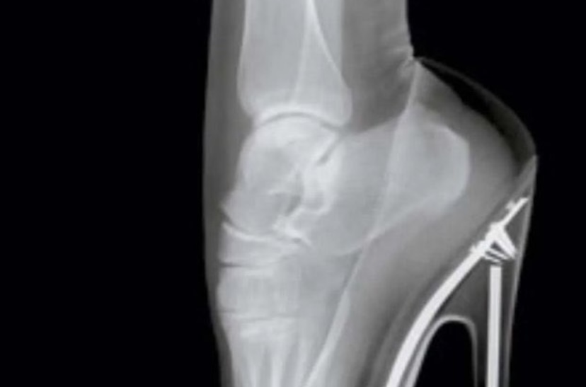 كبشتينه tweet media