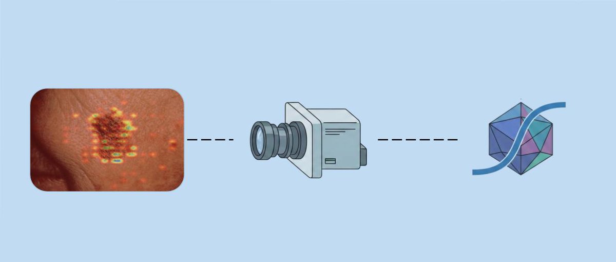 marcinstepien's tweet photo. Have been working with the MedGemma lately, specifically on MedSigLIP for Medical Image Interpretation, a  dermatology use case of identifying melanoma from mobile-captured photos. 
Here's a thread for my findings
#MedTech #HAI-DEF #HealthCare #Dermatology https://t.co/QaR8wY9LCx