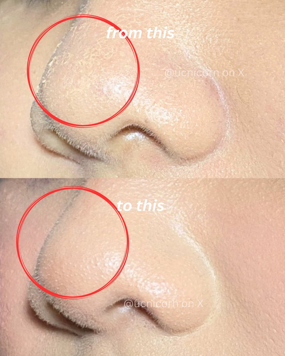 STOP OVER SKINCARE SEBELUM MAKEUP😔✋🏻

ini caraku biar makeup lebih nempel dan ga gampang longsor😉🫰🏻