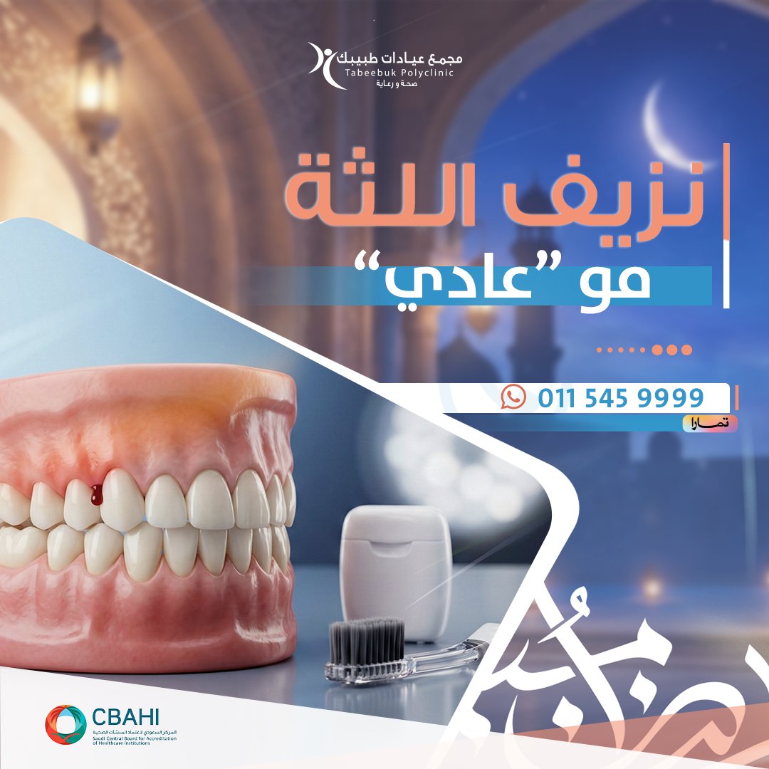 أكثر 4 أسباب شائعة:
✅ تفريش قوي/فرشاة قاسية
✅ إهمال الخيط بين الأسنان
✅ تراكم جير والتهاب لثة
✅ تدخين أو تغيّر هرمونات (خصوصًا عند بعض النساء)

وش تسوي من اليوم؟
فرشاة ناعمة + تفريش لطيف
خيط يوميًا (مرة تكفي)
مضمضة مناسبة إذا أوصى الطبيب
إذا النزيف مستمر أكثر من أسبوع… لازم