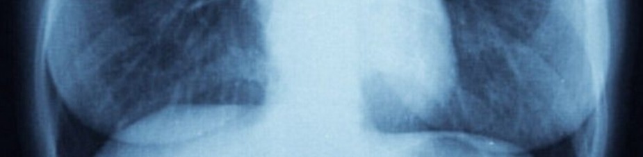 𝐒𝐮𝐧𝐧𝐲 🩶 tweet media