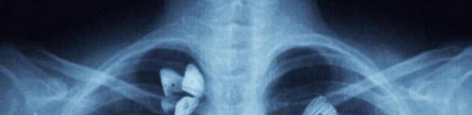 𝐒𝐮𝐧𝐧𝐲 🩶 tweet media