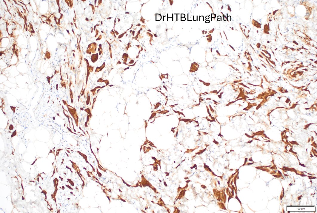 Humberto Trejo Bittar, MD, FCAP tweet media