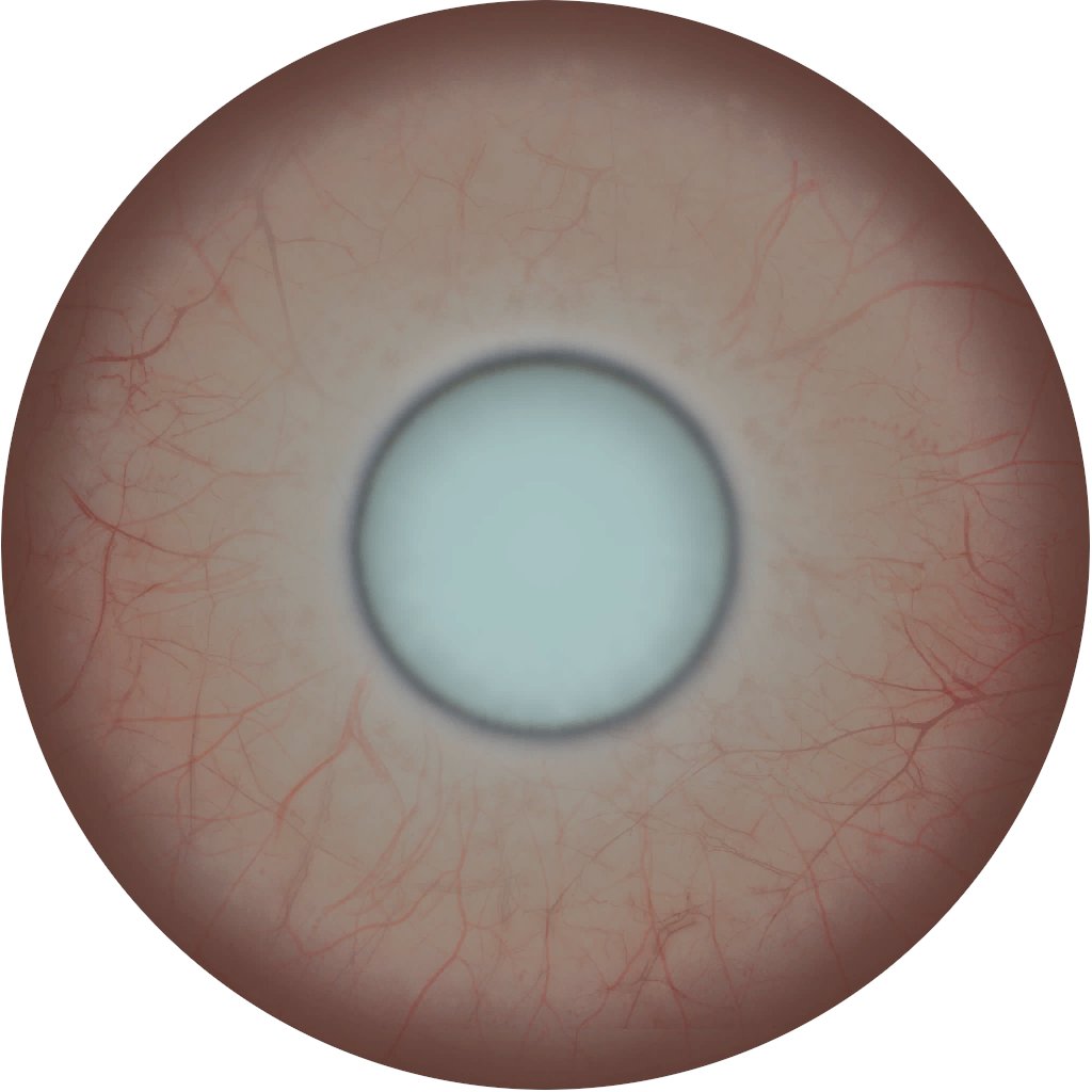 shieldgating's tweet photo. Some of the special eyes within the protoframes:

Roathe's reversed eye
Lyon Allard's iris, possessing a rare condition known as Polycoria
Eleanor Nightingale's infected sclera
Arthur Nightingale's injured left eye, affected with cataracts by Amir Beckett https://t.co/oyqx96QGLf