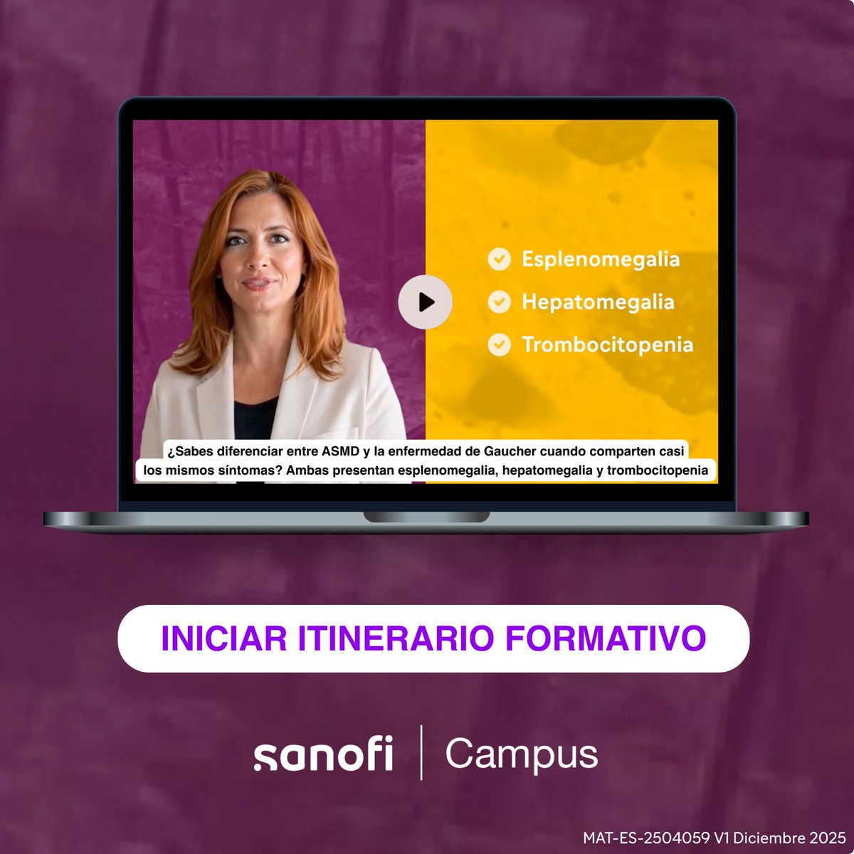 campussanofi's tweet photo. El diagnóstico de #Gaucher y #ASMD puede retrasarse más de 10 años, impactando el abordaje y seguimiento. 

GlorIA te acompaña en un itinerario formativo innovador para comprender mejor estas #EnfermedadesRaras.

👉https://t.co/7Ir7tu7Kjo