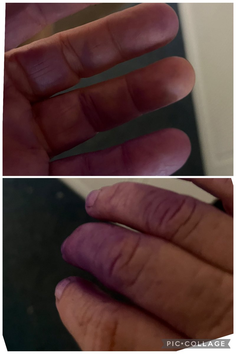 Surethaplaas's tweet image. How do you know she was spraying ticks on the sheep🫣🙋🏼‍♀️🤐🤫🤔🤔🤔 #farming #blessed #loveit #geelkoppan #hot #imafarmer