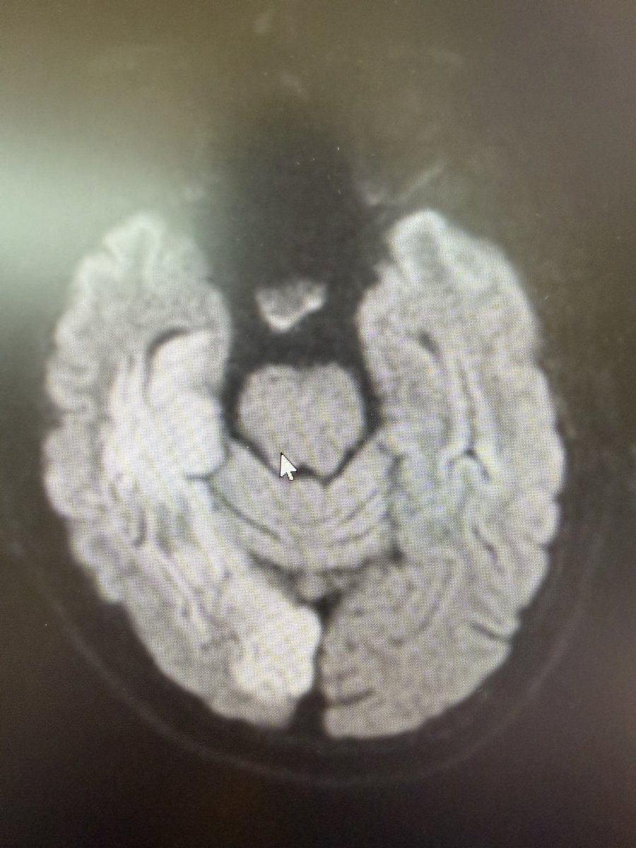 Anishee Undavia, MD tweet media