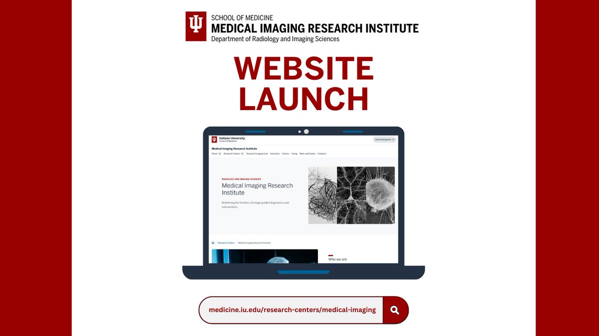 iumedimaging's tweet photo. The Medical Imaging Research Institute within @IURadiology at @IUMedSchool is redefining how we diagnose and treat patients through advanced cardiovascular imaging and neuroimaging research and an enhanced research imaging core.

Learn more at the link in our bio. https://t.co/jm2zE95u8n