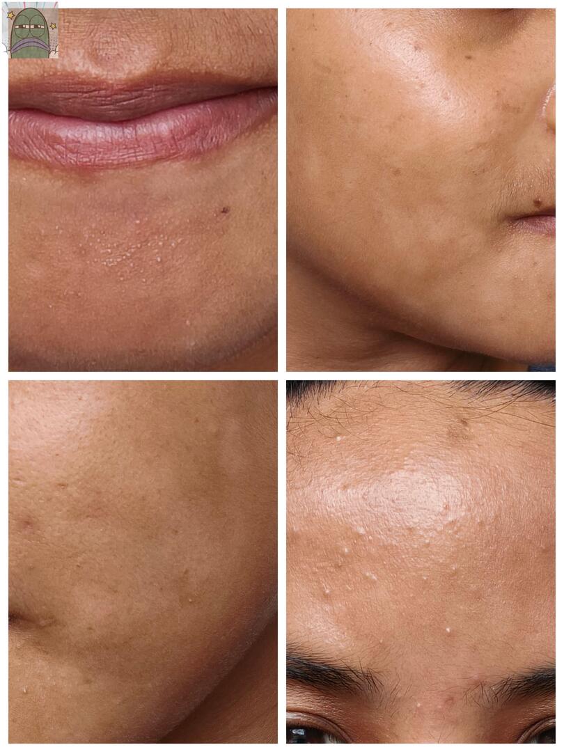 Tanyarlfes tweet media