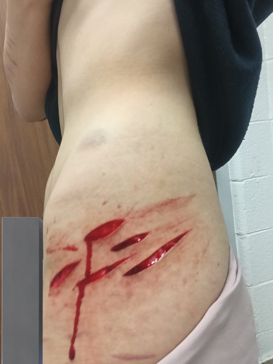 🪷Zoey🪷 tweet media