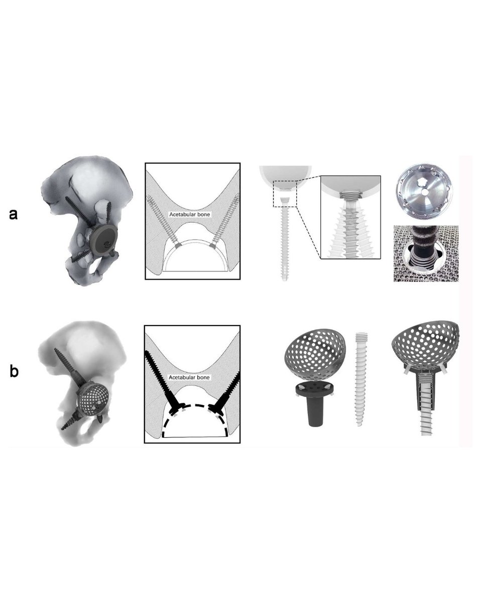 Bone & Joint Research tweet media