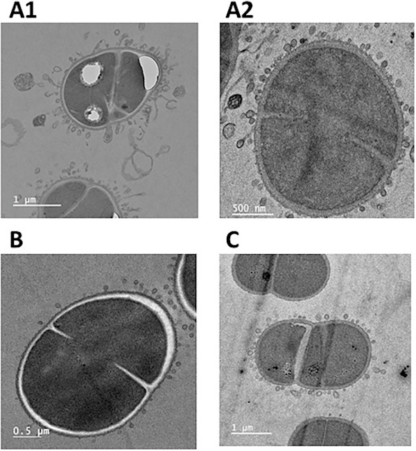 astrobiology's tweet image. Specific Role Of Two NlpC/P60 Endopeptidases In Cell Division And Membrane Vesicle Formation In Deinococcus radiodurans
astrobiology.com/2026/03/specif…  #astrobiology #extremophile #microbiology