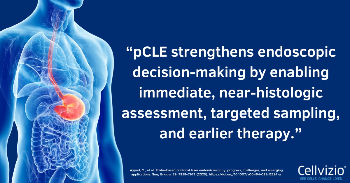 Cellvizio® by Mauna Kea Technologies tweet media