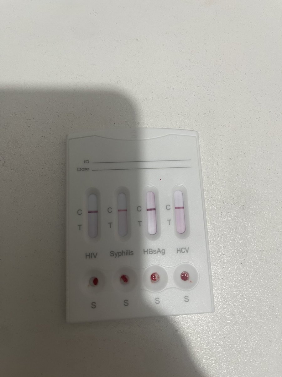 ml before dark tweet media