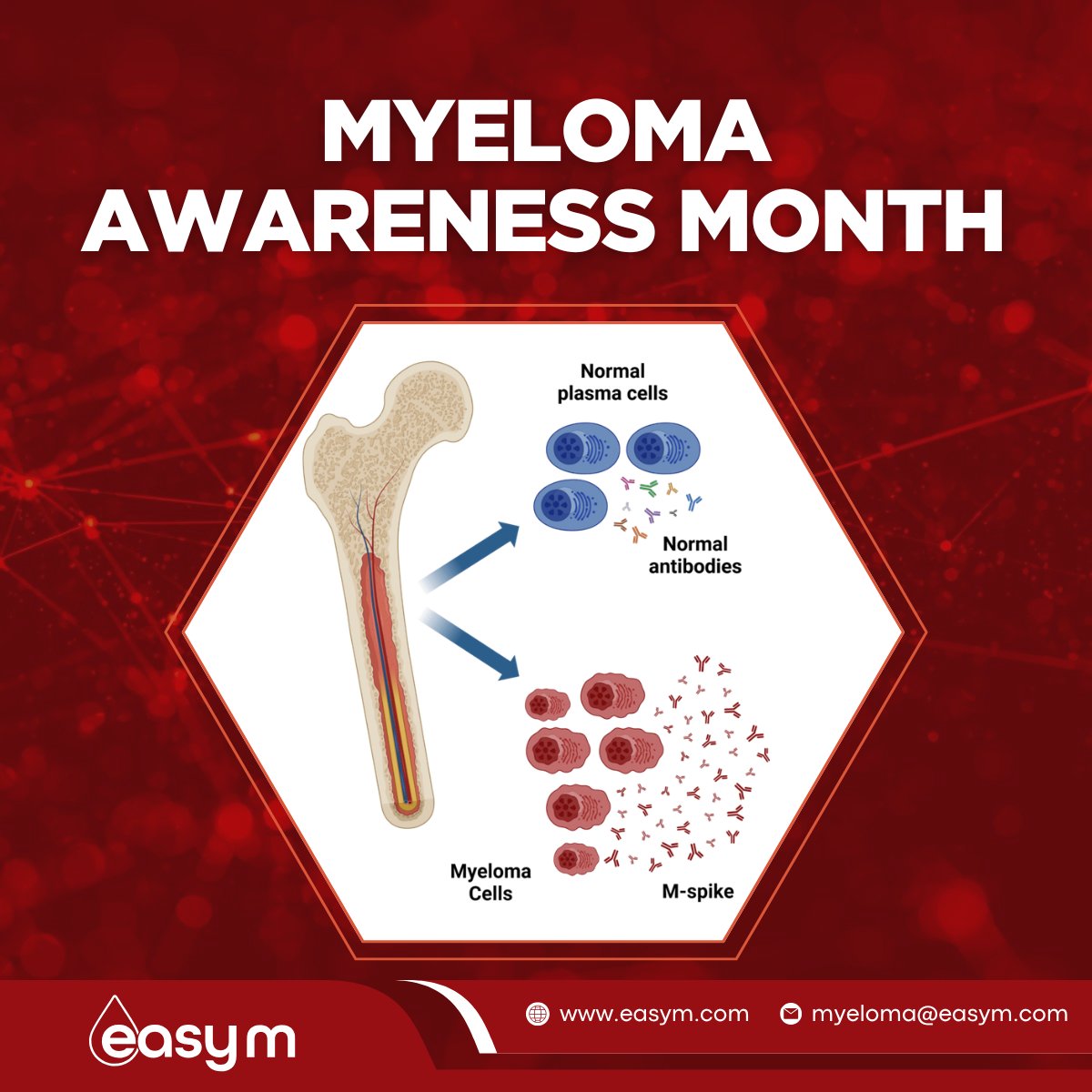 EasyM: Blood-based MRD for MM tweet media