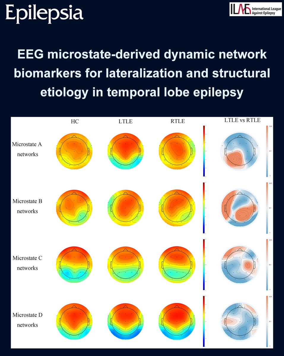 Epilepsia tweet media