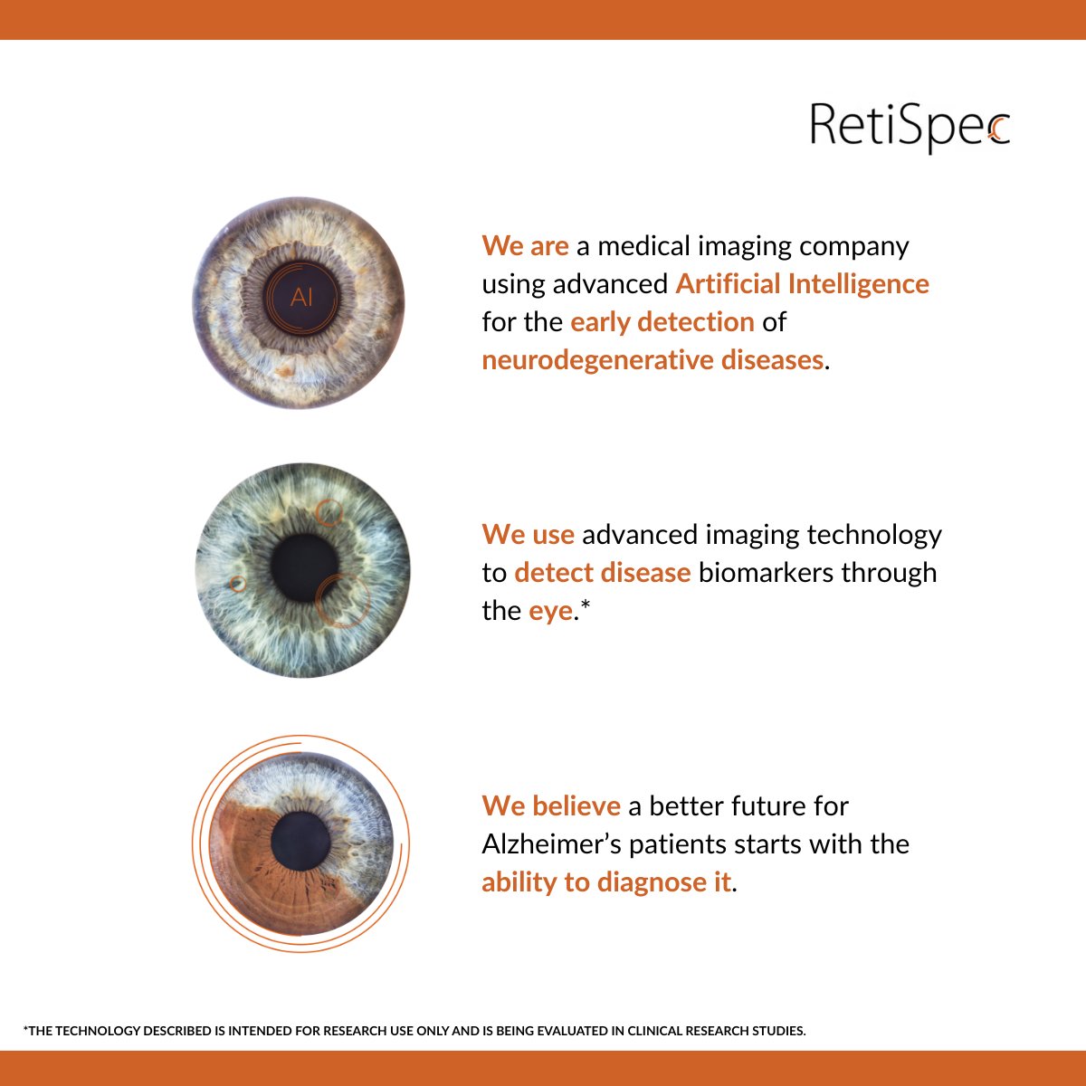 RetiSpec tweet media