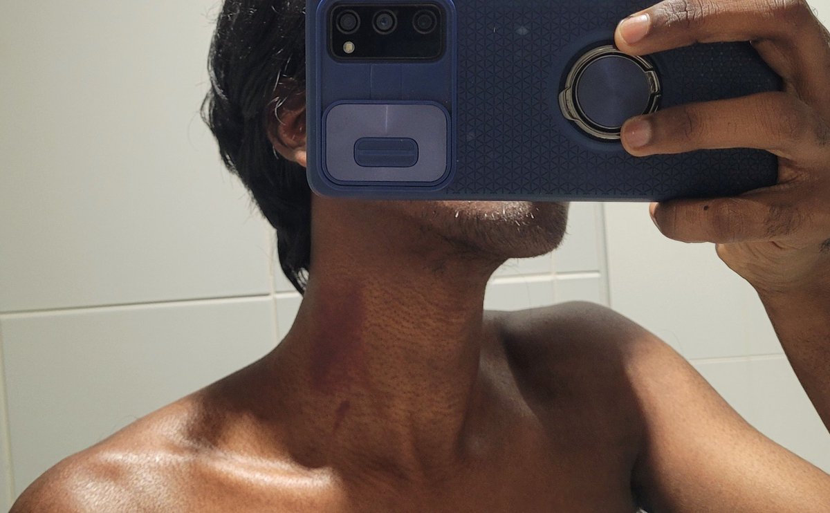 Batboi 🦇 tweet media