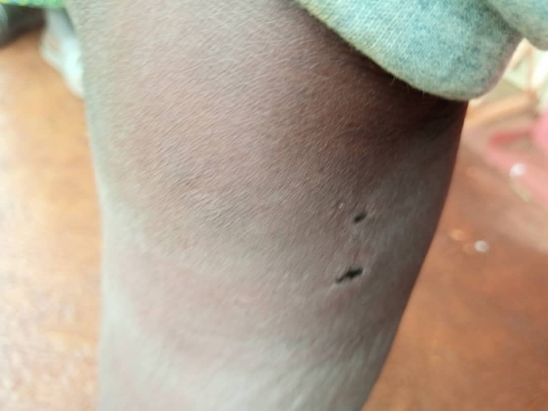 MagazineJimbere's tweet image. 🏥 Un garçon de 13 ans, originaire de la colline #Nkoyoyo, dans la commune de #Muyinga (@BuhumuzaProvinc), a été agressé et mordu par un chien appartenant à un agroéleveur, résident du quartier Swahili. Sa famille affirme ne pas disposer des ressources nécessaires pour payer les