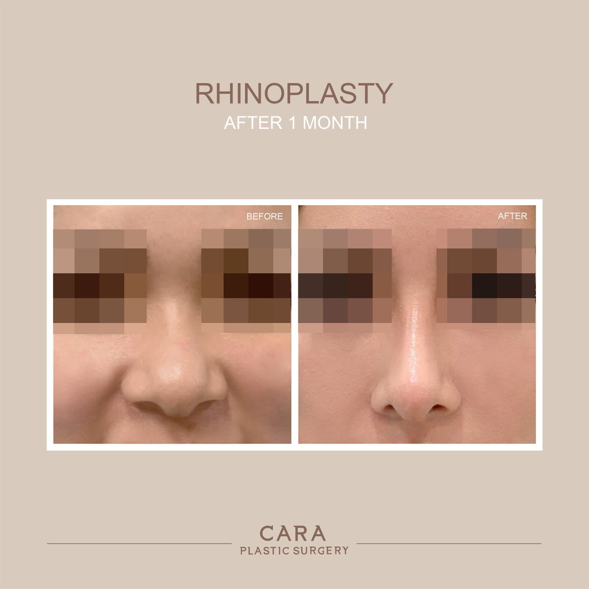 caraplasticsurgery tweet media
