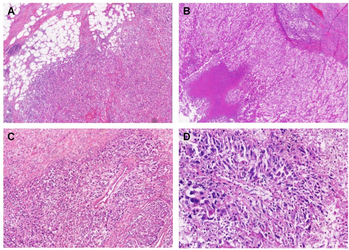 Human Pathology tweet media