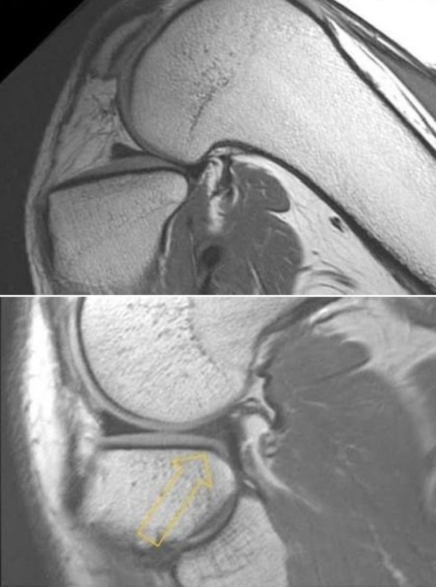Sean E. Sitton, MD tweet media