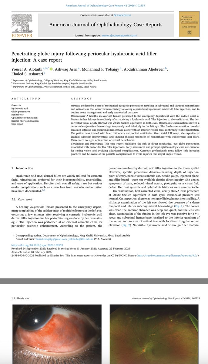 Aljebreeen's tweet photo. New publication in a Q2 journal 🙏

Read more;
https://t.co/VhzVAT5ubS https://t.co/zjQ1SX2ZTg