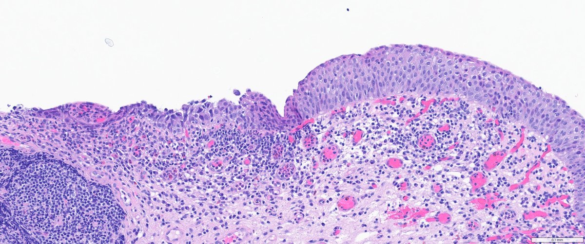 Ankur Sangoi tweet media