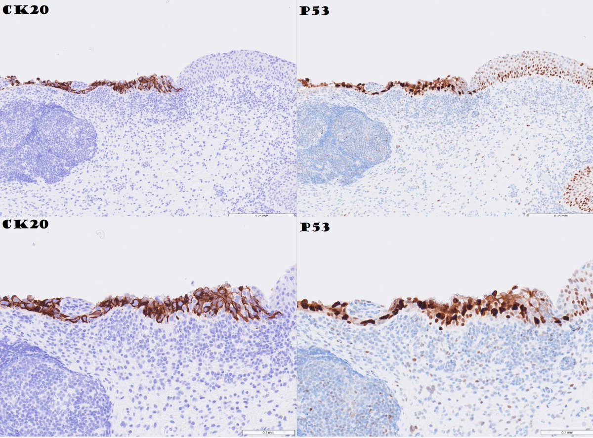 Ankur Sangoi tweet media